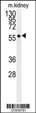 Anti-CA6 Rabbit Polyclonal Antibody