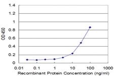 Anti-PGK1 Mouse Monoclonal Antibody [clone: 2H4]