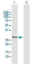 Anti-MPZL2 Rabbit Polyclonal Antibody