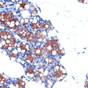 Immunohistochemistry analysis of paraffin-embedded rat brown adipose using Anti-UCP1 +UCP3 Antibody [ARC2304] (A307983) at a dilution of 1:100 (40X lens). Perform microwave antigen retrieval with 10 mM Tris/EDTA buffer pH 9.0 before commencing with IHC staining protocol