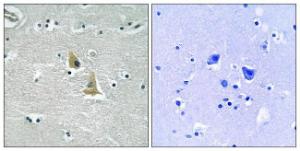 Immunohistochemical analysis of paraffin-embedded human brain tissue using Anti-p47 phox Antibody. The right hand panel represents a negative control, where the antibody was pre-incubated with the immunising peptide