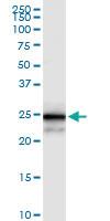 Anti-MPZL2 Rabbit Polyclonal Antibody