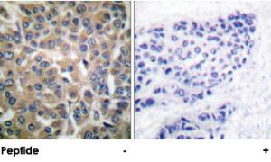 Anti-CTTN Rabbit Polyclonal Antibody