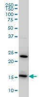 Anti-RPS17 Mouse Monoclonal Antibody [clone: 2C7]