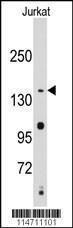 Anti-SMC2 Rabbit Polyclonal Antibody