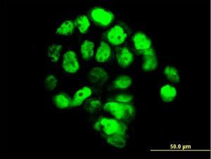 Anti-FOXA1 Mouse monoclonal antibody [clone: 4F6]