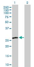 Anti-MPZL2 Rabbit Polyclonal Antibody