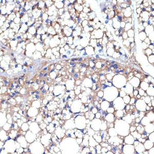 Immunohistochemistry analysis of paraffin-embedded mouse brown adipose using Anti-UCP1 +UCP3 Antibody [ARC2304] (A307983) at a dilution of 1:100 (40X lens). Perform microwave antigen retrieval with 10 mM Tris/EDTA buffer pH 9.0 before commencing with IHC staining protocol