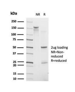 SDS-PAGE analysis of Anti-CHRAC17 Antibody [PCRP-POLE3-3D3] under non-reduced and reduced conditions; showing intact IgG and intact heavy and light chains, respectively. SDS-PAGE analysis confirms the integrity and purity of the antibody