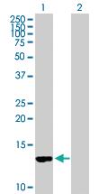 Anti-CD59 Mouse Polyclonal Antibody