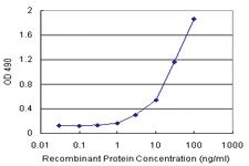 Anti-ABCC10 Polyclonal Antibody Pair