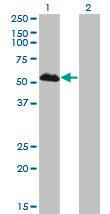 Anti-FOXA1 Mouse monoclonal antibody [clone: 2D7]