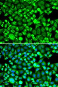 Immunofluorescence analysis of A549 cells using Anti-Proteasome 20S LMP7 Antibody (A306732). DAPI was used to stain the cell nuclei (blue).