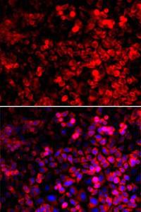 Immunofluorescence analysis of U2OS cells using Anti-GlnRS Antibody (A12047). DAPI was used to stain the cell nuclei (blue).