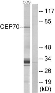 Western blot analysis of lysates from COS cells using Anti-CEP70 Antibody. The right hand lane represents a negative control, where the antibody is blocked by the immunising peptide.