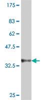 Anti-DTNB Mouse Polyclonal Antibody