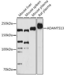 Western blot analysis of extracts of various cell lines, using Anti-ADAMTS13 Antibody [ARC1957] (A306733) at 1:1,000 dilution. The secondary antibody was Goat Anti-Rabbit IgG H&L Antibody (HRP) at 1:10,000 dilution.