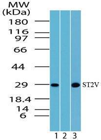 Anti-IL1RL1 Rabbit Polyclonal Antibody