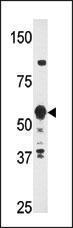 Anti-PRF-1 Rabbit Polyclonal Antibody (Biotin)