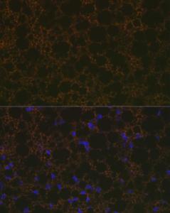 Immunofluorescence analysis of rat brown adipose cells using Anti-UCP1 +UCP3 Antibody [ARC2304] (A307983) at a dilution of 1:100 (40X lens). DAPI was used to stain the cell nuclei (blue)