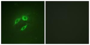 Immunofluorescence analysis of A549 cells using Anti-SEK1 Antibody. The right hand panel represents a negative control, where the antibody was pre-incubated with the immunising peptide.