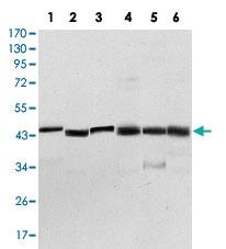 Anti-PDPK1 Mouse Monoclonal Antibody [clone: 4A11]