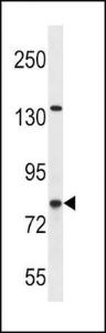 Anti-CPT1B Rabbit Polyclonal Antibody (AP (Alkaline Phosphatase))