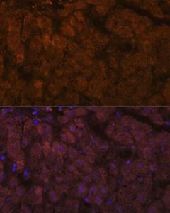 Immunofluorescence analysis of human liver using Anti-ADAMTS13 Antibody [ARC1957] (A306733) at a dilution of 1:100 (40x lens). DAPI was used to stain the cell nuclei (blue).