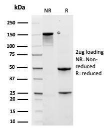 SDS-PAGE analysis of Anti-Cytokeratin 6A Antibody [rKRT6A/2100] under non-reduced and reduced conditions; showing intact IgG and intact heavy and light chains, respectively. SDS-PAGE analysis confirms the integrity and purity of the antibody