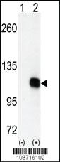 Anti-DGKZ Rabbit Polyclonal Antibody