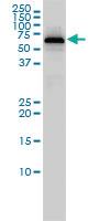 Anti-PGM1 Mouse Monoclonal Antibody [clone: 3B8-H4]