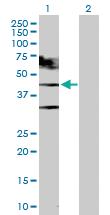 Anti-TARDBP Rabbit Polyclonal Antibody