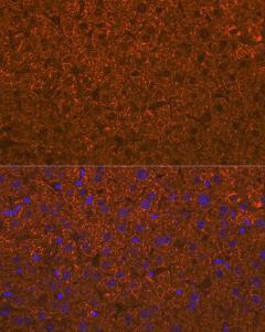 Immunofluorescence analysis of mouse liver using Anti-ADAMTS13 Antibody [ARC1957] (A306733) at a dilution of 1:100 (40x lens). DAPI was used to stain the cell nuclei (blue).