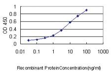 Anti-TRIM13 Mouse Monoclonal Antibody [clone: 2A11]