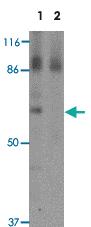 Anti-ESRP1 Rabbit Polyclonal Antibody