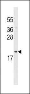 Anti-ADI1 Rabbit Polyclonal Antibody (FITC (Fluorescein Isothiocyanate))