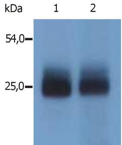 Western Blotting analysis (non-reducing conditions) of mouse NTAL in mouse spleen tissue Lane 1: Immunostaining with Anti-NTAL Antibody (A85965) Lane 2: Immunostaining with Anti-NTAL Antibody (A85805)(specific for N-terminal domain of mouse NTAL)