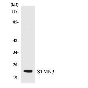 Western blot analysis of the lysates from K562 cells using Anti-STMN3 Antibody