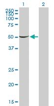 Anti-PGM1 Mouse Monoclonal Antibody [clone: 3B8-H4]