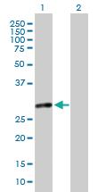 Anti-MMS19 Mouse Polyclonal Antibody