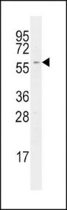 Anti-RIPK2 Rabbit Polyclonal Antibody (AP (Alkaline Phosphatase))