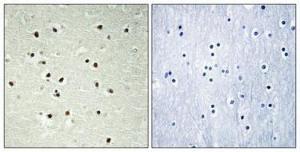 Immunohistochemical analysis of paraffin-embedded human brain using Anti-CEP70 Antibody 1:100 (4°C overnight). The right hand panel represents a negative control, where the antibody was pre-incubated with the immunising peptide.