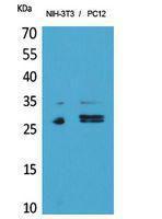 Anti-DcR1 Rabbit Polyclonal Antibody