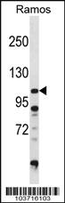 Anti-DGKZ Rabbit Polyclonal Antibody