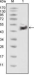 Anti-TP53 Mouse Monoclonal Antibody [clone: 13B597]