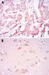 Anti-PDPK1 Mouse Monoclonal Antibody [clone: 4A11]