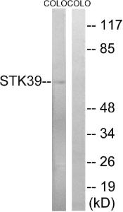 Western blot analysis of lysates from COLO cells using Anti-STK39 Antibody. The right hand lane represents a negative control, where the antibody is blocked by the immunising peptide