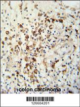 Anti-HAUS5 Rabbit Polyclonal Antibody