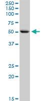 Anti-CNDP1 Rabbit Polyclonal Antibody