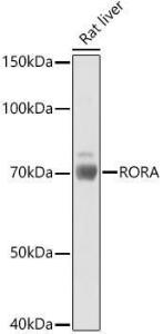 Western blot analysis of extracts of Rat liver, using Anti-ROR alpha / RORA Antibody (A12052) at 1:1,000 dilution. The secondary antibody was Goat Anti-Rabbit IgG H&L Antibody (HRP) at 1:10,000 dilution.